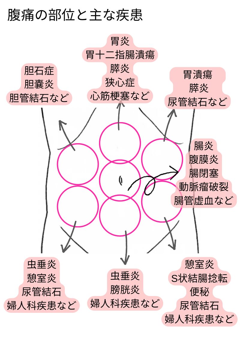 【症状別看護】腹痛に対する症候学 Er Nurse Hot Line 